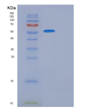 Recombinant Human GPT Protein