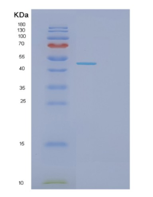 Recombinant Human GLOD4 Protein