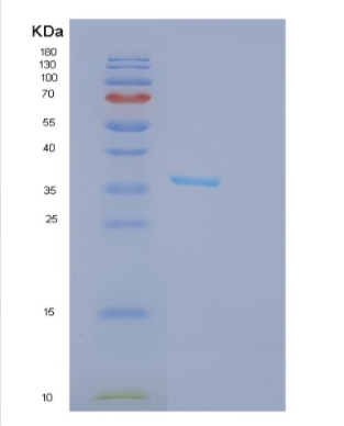 Recombinant Human GPD1 Protein