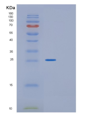 Recombinant Human GLTP Protein