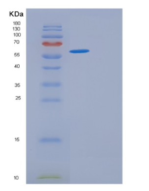 Recombinant Human GPT2 Protein