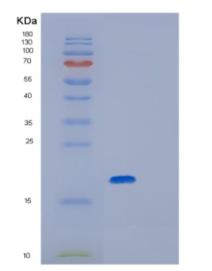 Recombinant Human GPX7 Protein