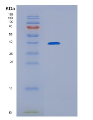 Recombinant Human GRAP2 Protein