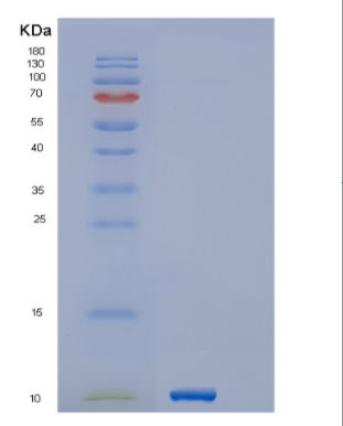 Recombinant Human GNGT1 Protein