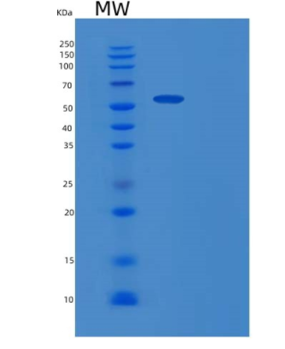 Recombinant Mouse Gpt Protein