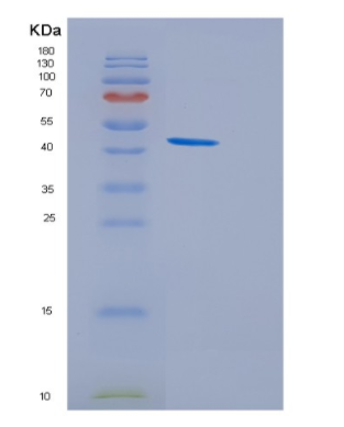 Recombinant Human GSK3B Protein