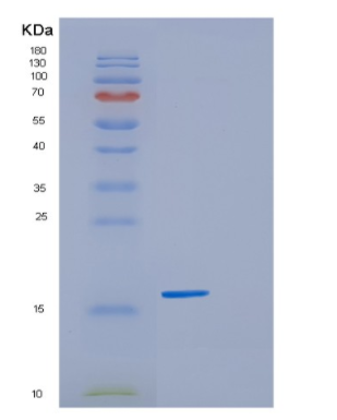 Recombinant Human GSKIP Protein