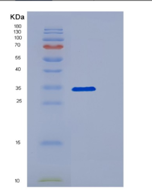 Recombinant Human DCK Protein