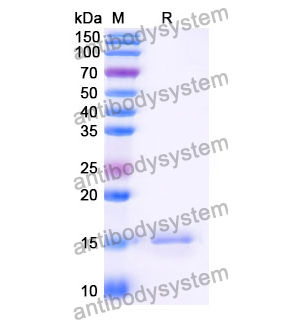 Anti-Human ATP7B Nanobody (SAA1241)