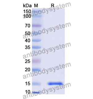 Anti-Vibrio cholerae higB-2 Nanobody (SAA0851)