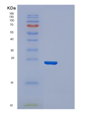 Recombinant Human Cysteine dioxygenase Protein