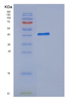 Recombinant Human CYTIP Protein