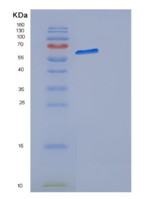 Recombinant Human DARS Protein