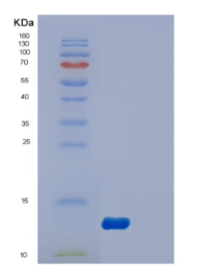 Recombinant Human DYNLL2 Protein