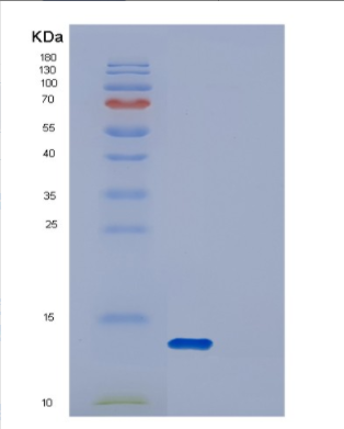 Recombinant Human DYNLRB2 Protein