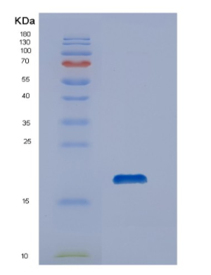 Recombinant Human DUSP19 Protein