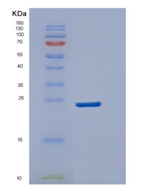 Recombinant Human DUSP18 Protein