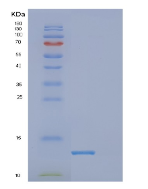 Recombinant Human DPY30 Protein