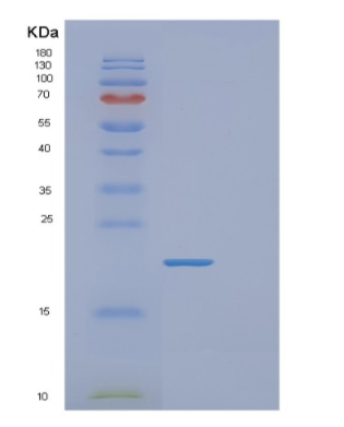 Recombinant Human FABP3 Protein