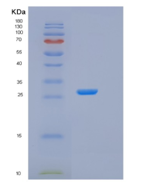 Recombinant Human GSTA4 Protein