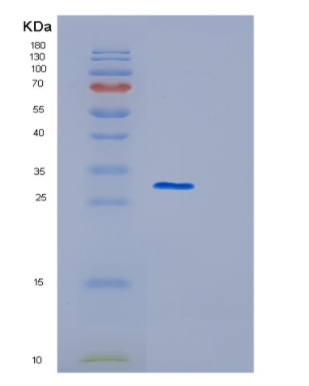 Recombinant Human GSTM3 Protein