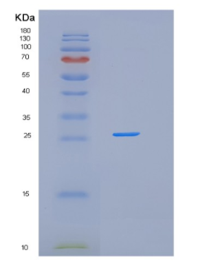 Recombinant Human GSTO1 Protein