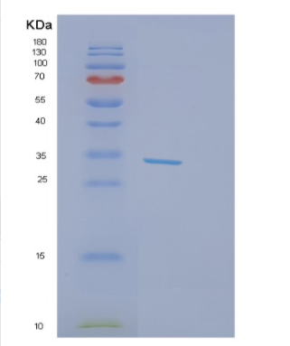 Recombinant Human GSTT1 Protein