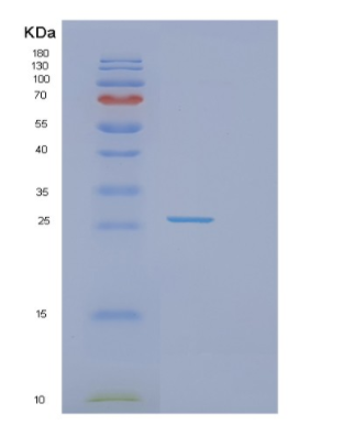 Recombinant Human GSTZ1 Protein