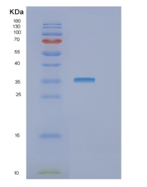 Recombinant Human GTF2B Protein