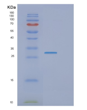 Recombinant Human GTF2F2 Protein