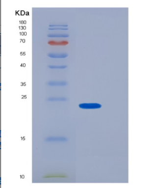 Recombinant Human GUK1 Protein