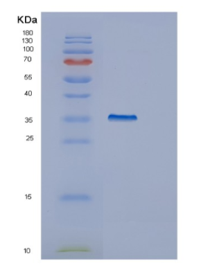 Recombinant Human GULP1 Protein