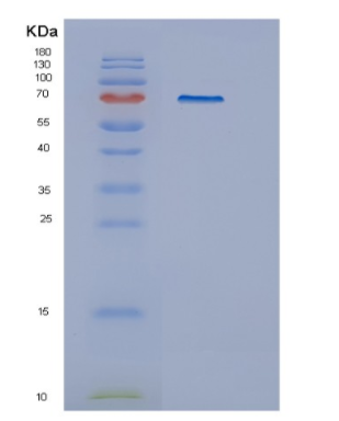 Recombinant Human GUSB Protein