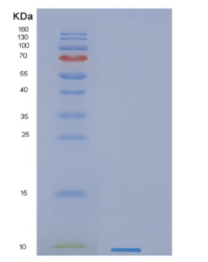 Recombinant Human GYPC Protein