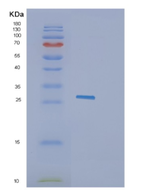 Recombinant Human GZMK Protein