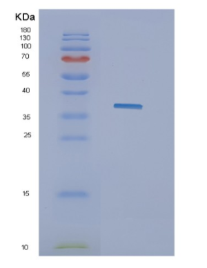 Recombinant Influenza A (H5N1)H5N1/HA Protein