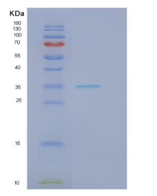Recombinant Human HAAO Protein