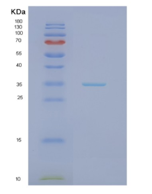 Recombinant Human HADH Protein