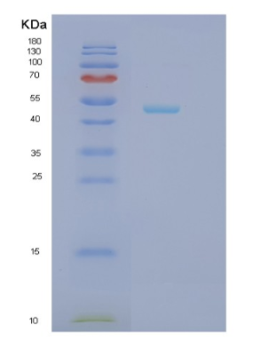 Recombinant Human HADHB Protein