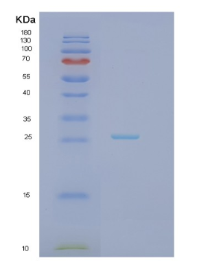 Recombinant Human HAND1 Protein