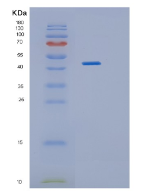 Recombinant Human HAO1 Protein