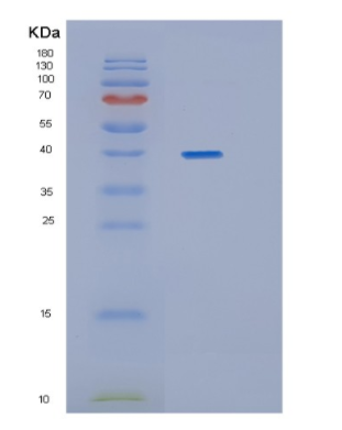 Recombinant Human HAPLN1 Protein