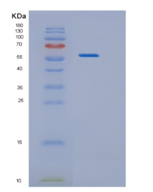 Recombinant Human HARS Protein