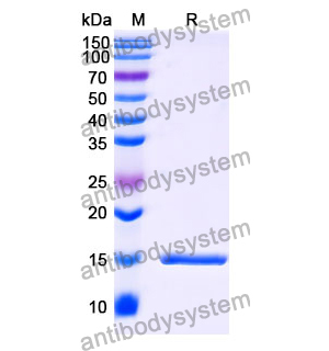 Anti-Human CALCA/Calcitonin Nanobody (SAA1243)