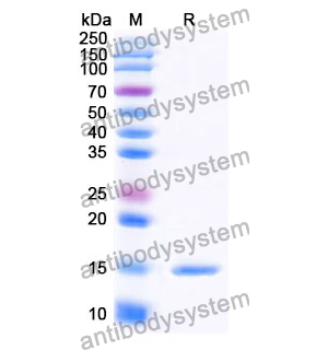 Anti-Human SLC10A1 Nanobody (SAA1145)