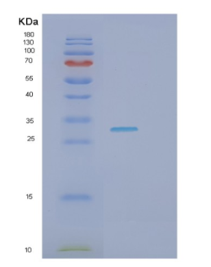 Recombinant Human HAVCR1 Protein