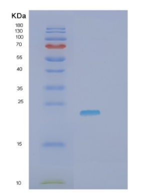 Recombinant Human HAVCR2 Protein