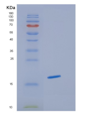 Recombinant Human HBG1 Protein