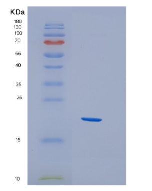 Recombinant Human HBXIP Protein