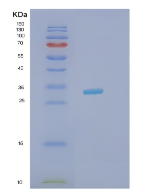 Recombinant Human HAX1 Protein